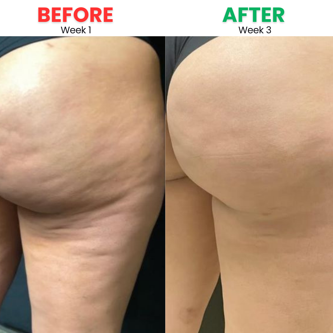 Before and After