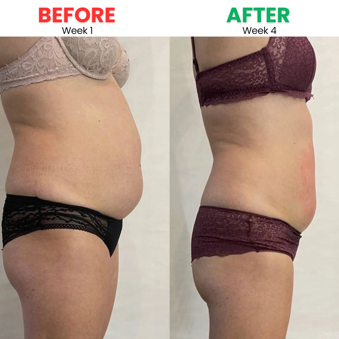 Before and After