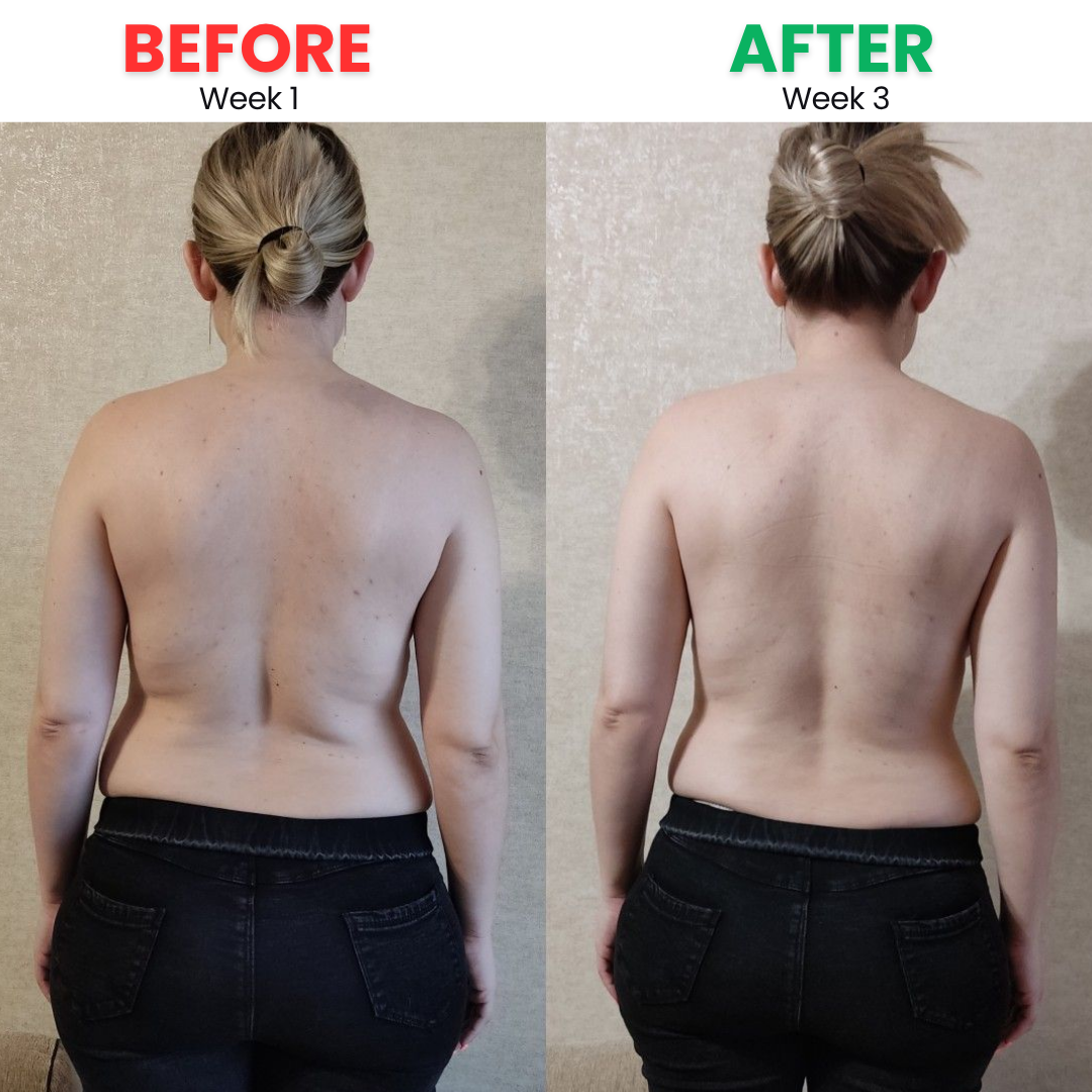 Before and After