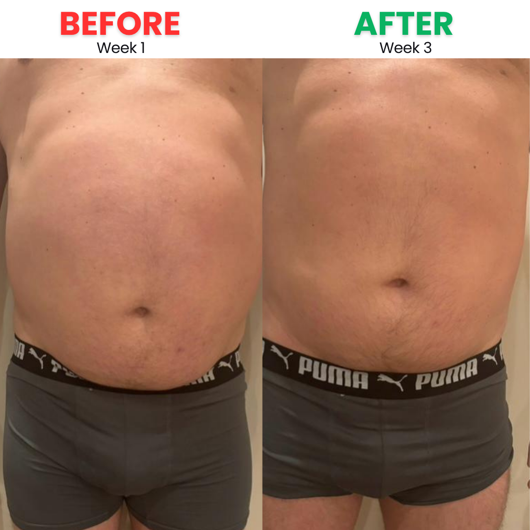Before and After