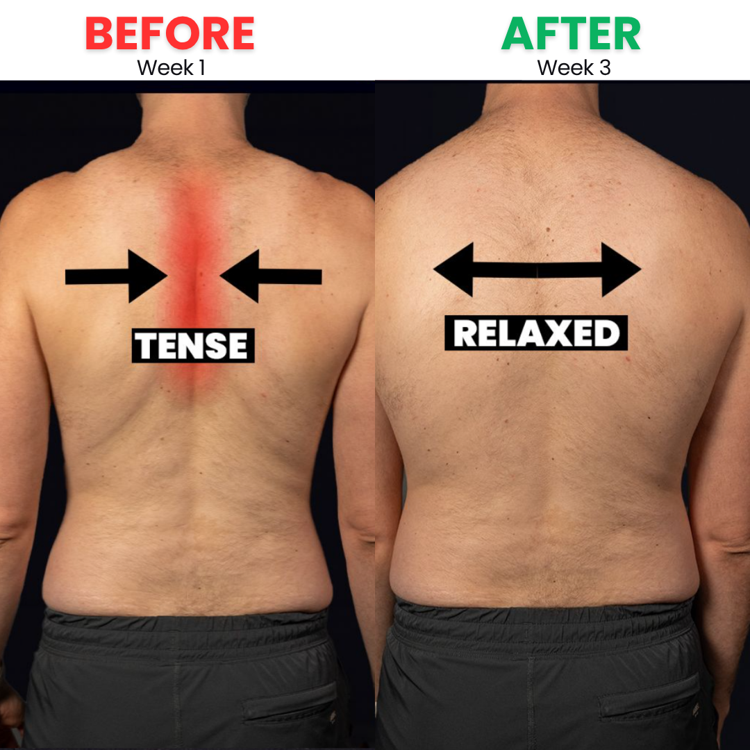 Before and After